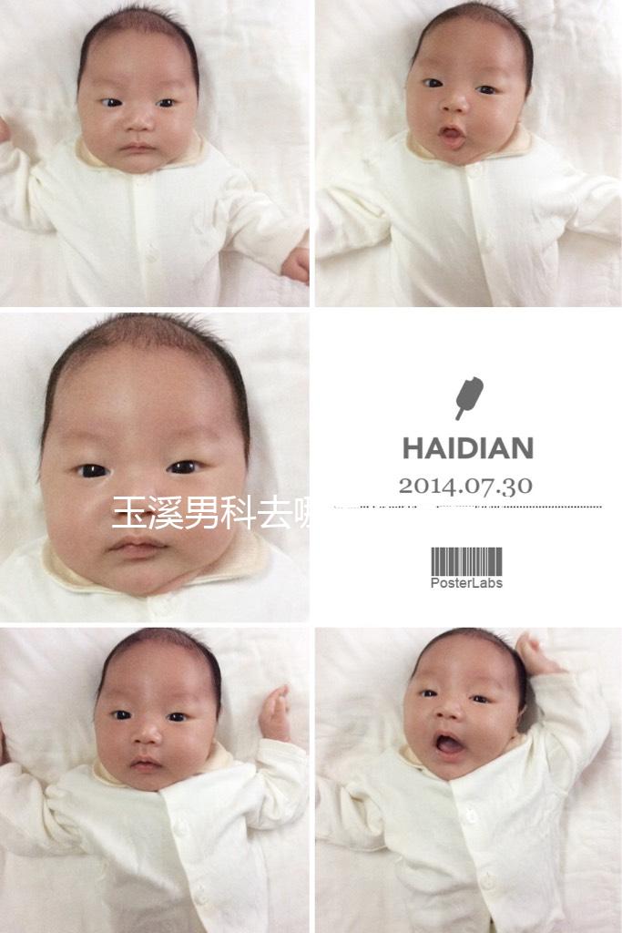 玉溪男科去哪家醫院看好，怎么選攻略，這個排行榜不要錯過