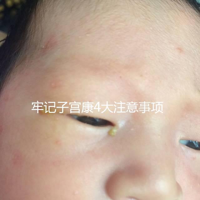 牢記子宮康4大注意事項，輕松避免胃脹、腹瀉等副作用