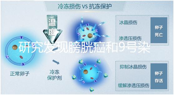研究發現膀胱癌和9號染色體缺失有關系!
