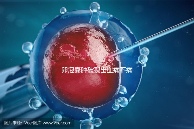 卵泡囊腫破裂出血痛不痛?經歷過的姐妹們給出回應