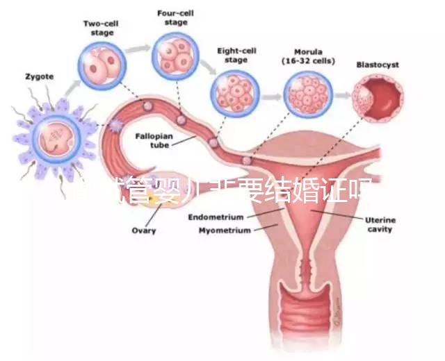做試管嬰兒非要結婚證嗎？做試管嬰兒一定需要結婚證嗎？