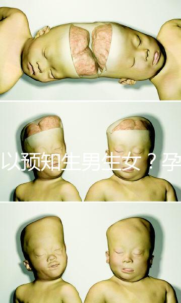 可以預知生男生女？孕婦夢見馬的胎夢解讀