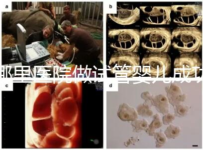 哪里醫(yī)院做試管嬰兒成功率高(一代試管成功率有多高)