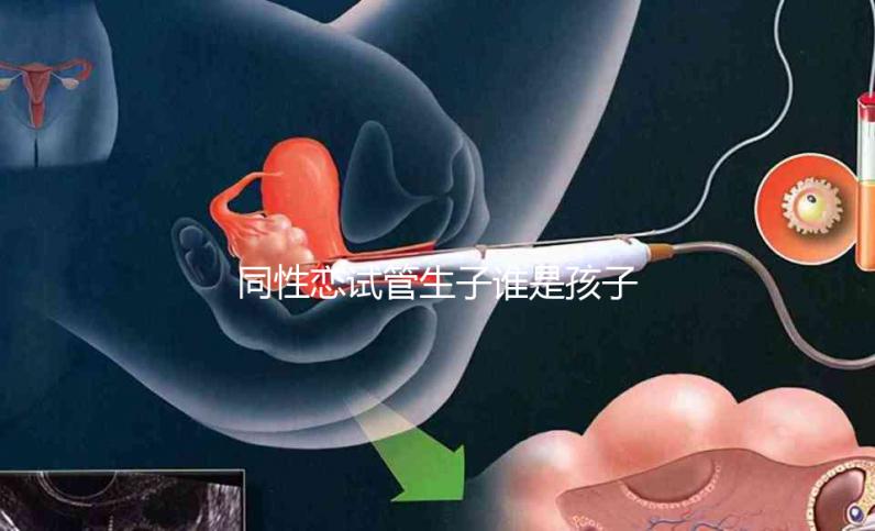 同性戀試管生子誰是孩子爸惹爭議!血緣關系竟成迷