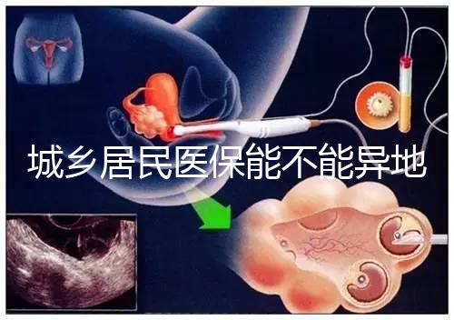 城鄉(xiāng)居民醫(yī)保能不能異地試管報(bào)銷?詳解2025試管醫(yī)保異地報(bào)銷的流程