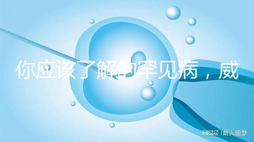 你應該了解的罕見病，威廉姆斯綜合癥