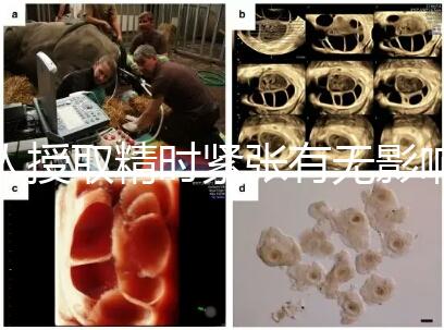 人授取精時緊張有無影響別還不造，注意事項不少不可不知