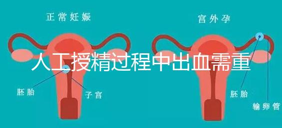 人工授精過(guò)程中出血需重視!這3種情況會(huì)影響成功率