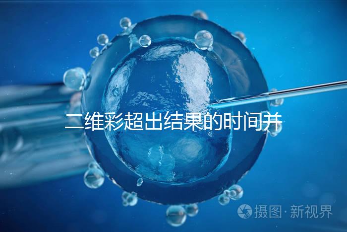 二維彩超出結果的時間并不長，從檢查流程便可看出