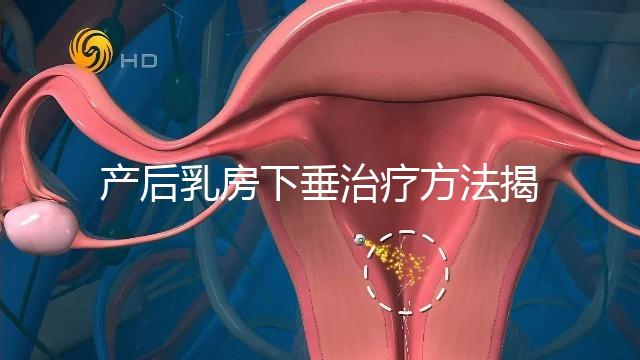 產(chǎn)后乳房下垂治療方法揭秘,按摩手法再好也沒提前預防有用