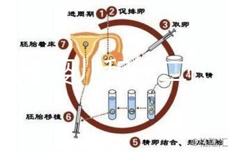 代試管嬰兒和第二代試管嬰兒的區(qū)別，基因篩查技術！