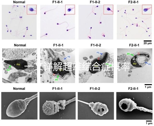 一文詳解超雄綜合癥概率有多大，想造的人多不多看過(guò)來(lái)