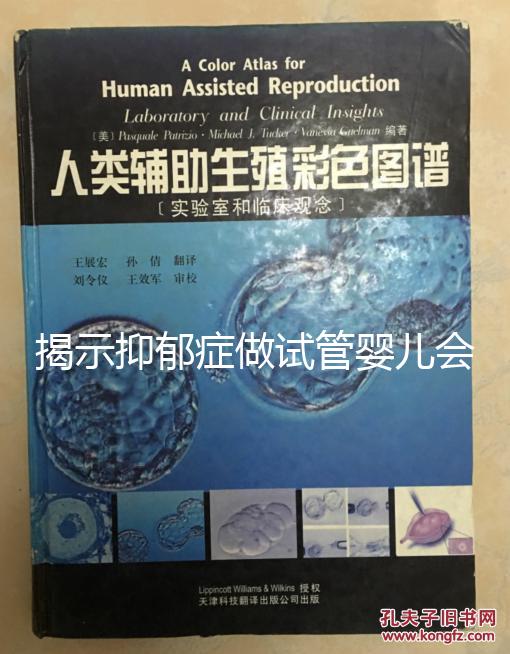 揭示抑郁癥做試管嬰兒會(huì)遺傳給女兒，想避免看這個(gè)