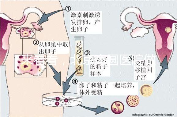 來看看，北京家圓醫院做三代試管費用總共多少？