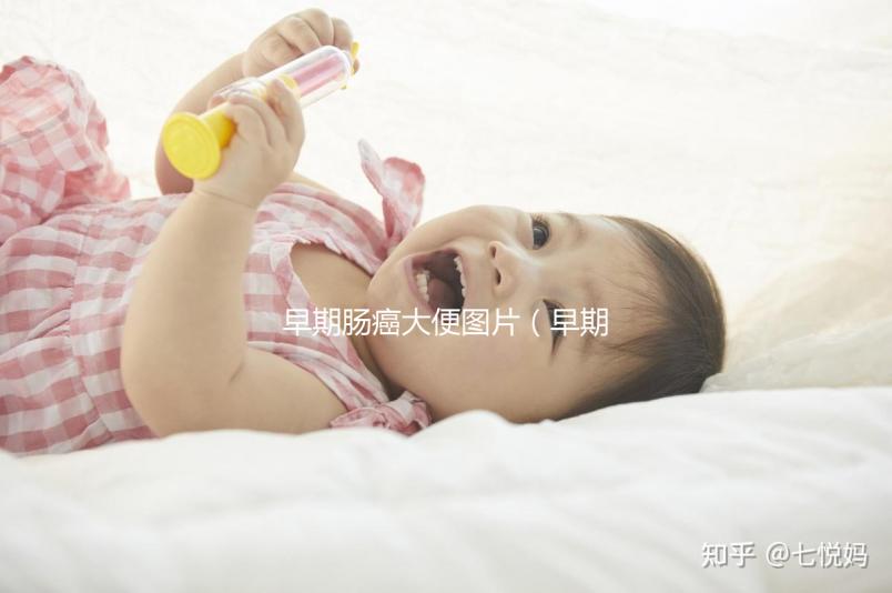 早期腸癌大便圖片（早期腸癌大便圖片 前兆）