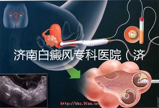 濟(jì)南白癜風(fēng)專科醫(yī)院(濟(jì)南白點癲風(fēng)醫(yī)院排名)