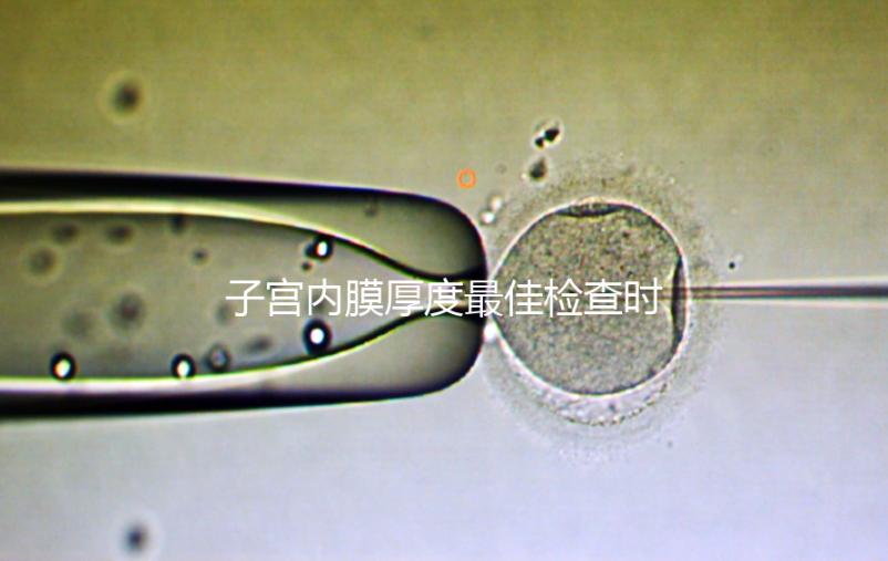 子宮內(nèi)膜厚度最佳檢查時(shí)期,你有必要提前知道!