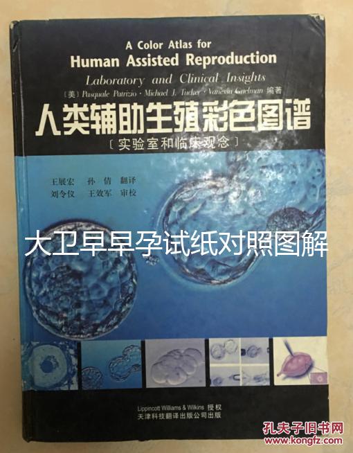 大衛早早孕試紙對照圖解，教你怎么看結果是不是陽性