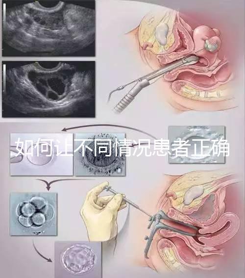 如何讓不同情況患者正確進(jìn)行人工授精,看看相因醫(yī)生怎么說