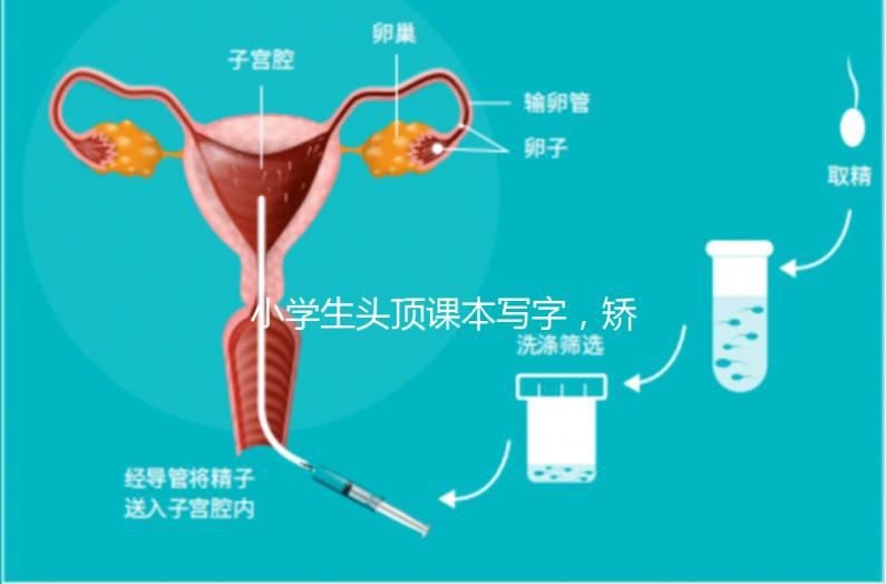 小學(xué)生頭頂課本寫字,矯正孩子坐姿還是學(xué)校更勝一籌