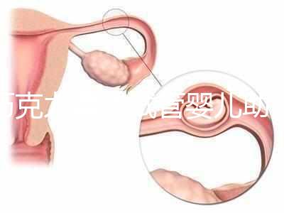 巧克力囊腫試管嬰兒助孕應先治療？網友看法均有差異