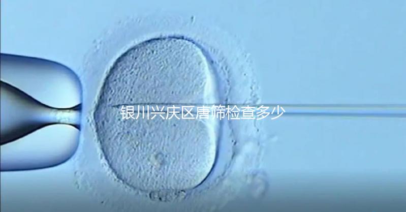 銀川興慶區(qū)唐篩檢查多少錢取決于情況，2024年國家免費限額