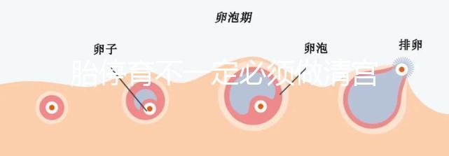 胎停育不一定必須做清宮！不滿足這3種情況,無需要刮宮
