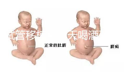 試管移植前幾天喝酒了有影響嗎？想要懷孕得管住嘴！