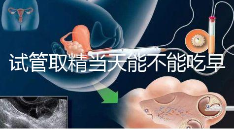 試管取精當天能不能吃早餐喝水的答案來咯咯，好不好一看就知道了？