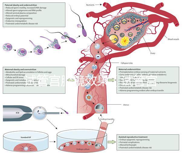 試管宮腔鏡效果（試管宮腔鏡效果怎么樣）