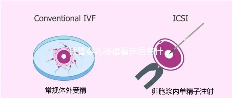 試管嬰兒移植著床后有什么反應(yīng)(試管嬰兒移植著床后有什么反應(yīng)嗎)