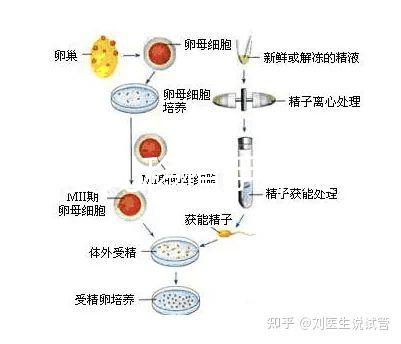 試管嬰兒移植手術疼嗎（試管失敗第二次收費嗎）