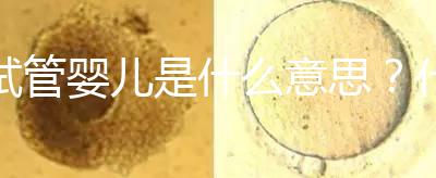試管嬰兒是什么意思？什么是試管嬰兒？