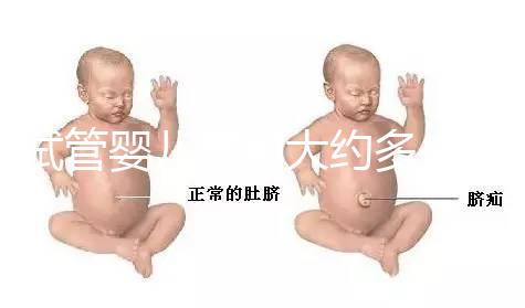 試管嬰兒費用大約多少2021年：國內(nèi)試管之（10）額外可能需要費用：