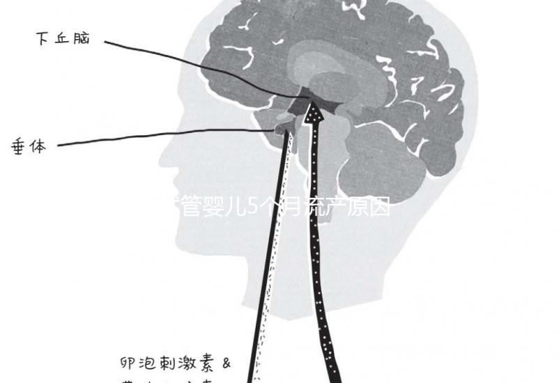 試管嬰兒5個(gè)月流產(chǎn)原因有三，多久能再次移植需慎重考慮