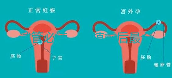 試管必讀，移植前后最全注意事項(xiàng)？