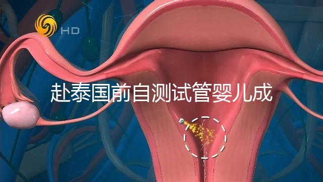 赴泰國(guó)前自測(cè)試管嬰兒成功率,這些方法值得收藏