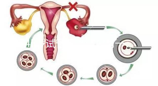 45歲試管促排卵只有一個卵泡不正常別數(shù)了我該怎么辦?