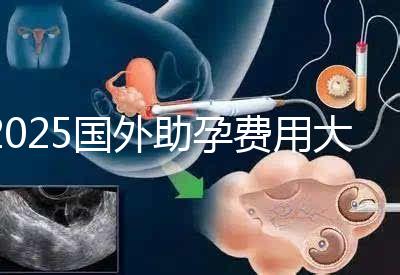 2025國外助孕費用大公開:單身人士費用對比與機構推薦