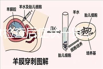 tct檢查后癥狀一覽，專家提醒做好處理措施是關鍵